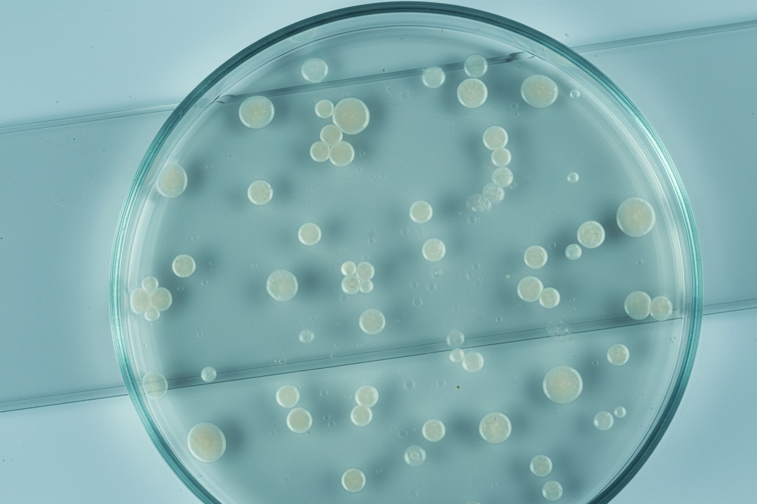 Bacteria growth on agar plate